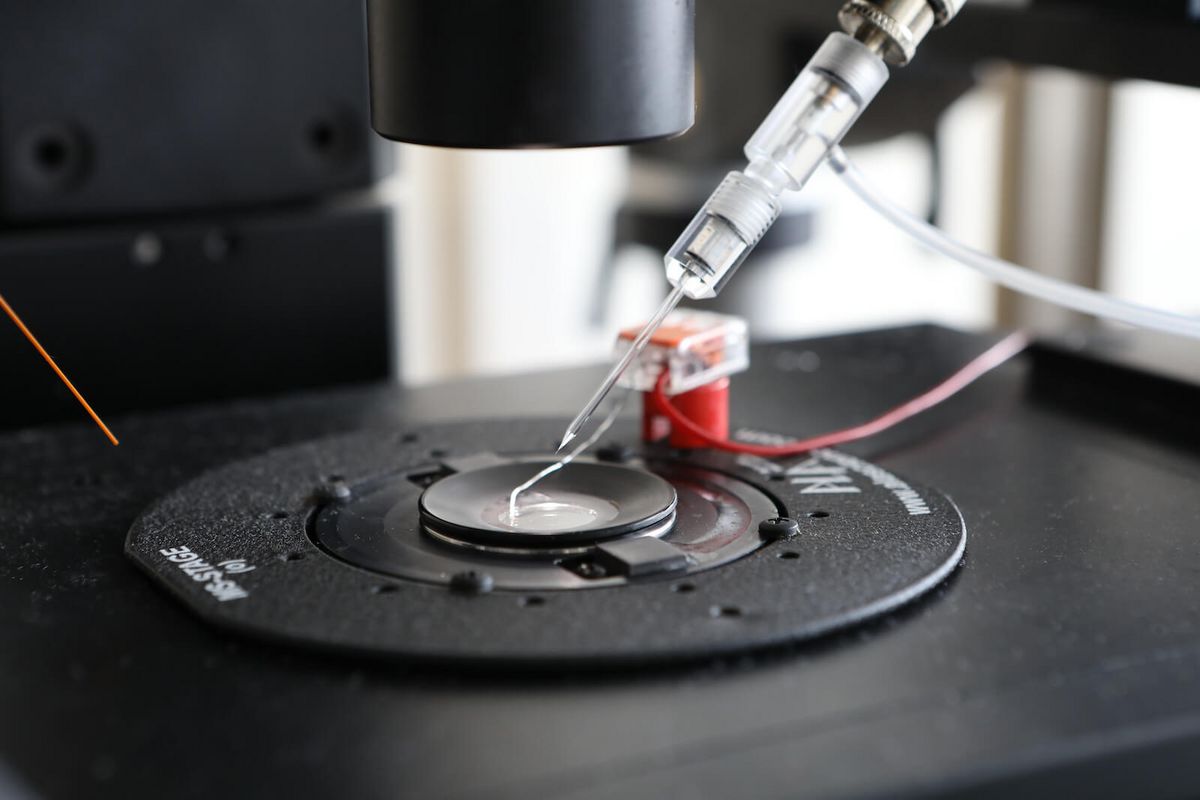 Patch Clamp EN